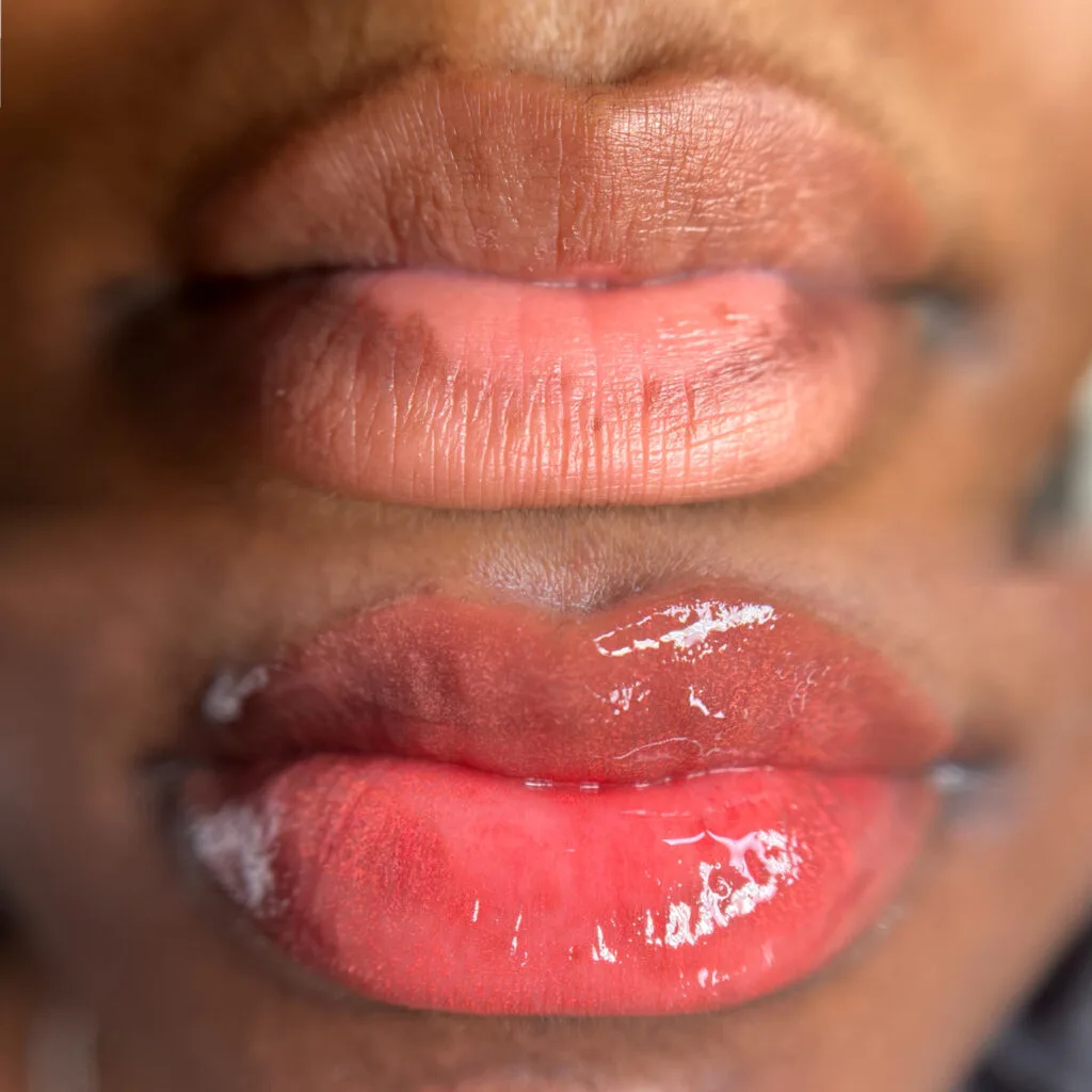Lip neutralisation before and after — deeper skin tone treated to glossy coral